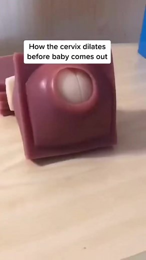 Cervical Dilation 🎥//:Midwifemama #midwife #Midwife_Engineer | Midwife Engineer