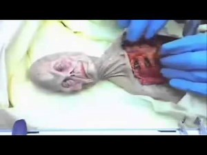 Gruesome Vintage Footage Shows Russian Alien Autopsy