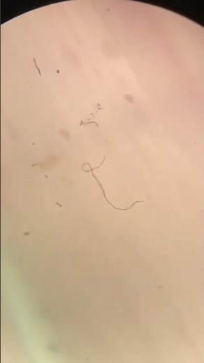 Enlarging Beef Under the Microscope 🔬