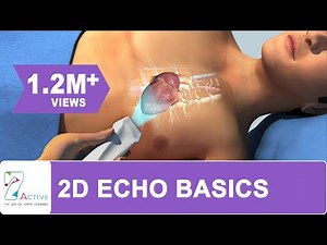 2D ECHO PROCEDURE