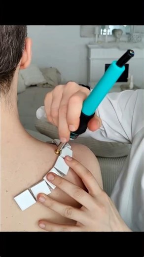 Shoulder skin examination