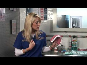 Dental Health : How Many Permanent Teeth Should I Have?