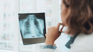X ray, analysis and woman doctor thinking of healthcare research, solution and review of skeleton, spine problem. Radiology professional, medical worker or female in xray anatomy career contemplating