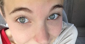 Trop maigre, elle poste des photos pour raconter son calvaire