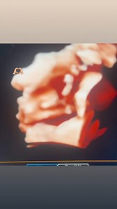 6.7K views · 105 reactions | Sending baby dust and positive energy to everyone who needs it. #ObGynLife #OBGYNUltrasoundSubspecialist #PregnancyJourney #OBGYNUltrasound #3D4D | Snippets of OBGYN Life | Facebook