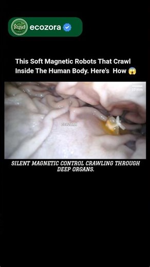 This Spider-Inspired GI Robots Changing Medicine Forever 😱 #biotech #future #innovation #nanorobots