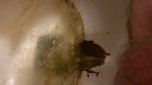 Laxative Diarrhea - video 4