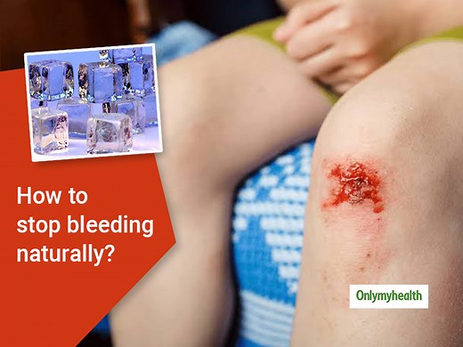 Try These 8 Natural Effective Remedies To Stop Bleeding From Wounds