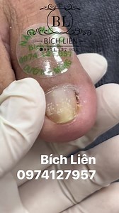 38K views · 363 reactions | Liên của ngày hôm qua ú u ú ù | Bích Liên Hoa Sen | Facebook