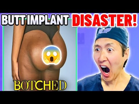 Plastic Surgeon Reacts to BOTCHED! Extreme Compilation!