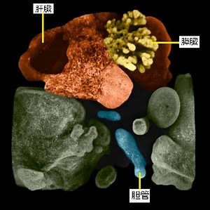 東京医歯大、世界初、ｉＰＳ細胞から「ミニ多臓器」作製＝肝臓・胆管・膵臓