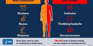 Know the difference between heat stroke and exhaustion