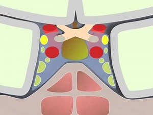 1.2K views · 39 reactions | 3rd nerve palsy | DR A.B.C | Facebook