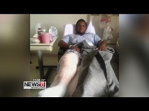 Teen injured in Waterbury hit-and-run speaks out