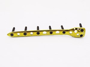 [Hot Item] Placa de bloqueo condílea humeral proximal para implantes quirúrgicos de alta venta