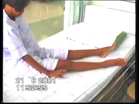 4.5. Sydenham's Chorea - Choreiform Disorders [Spring Video Atlas]