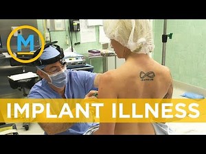 One Woman's journey and health struggles with breast implants | Your Morning