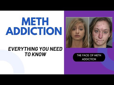 Methamphetamine (Meth) Addiction: Facts, Signs & Symptoms – What You Need to Know