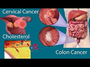 Screening Tests Every Woman and Men Need