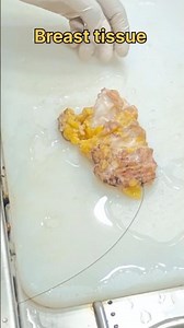 Breast tissue processing| #histopathology #histomuseum #breastcancerawareness #breastcancer #breast