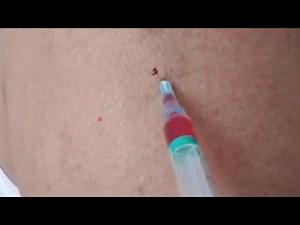 girl getting injection crying painful #intramuscular #Love #Viral #intramuscularinjection #asmrmass
