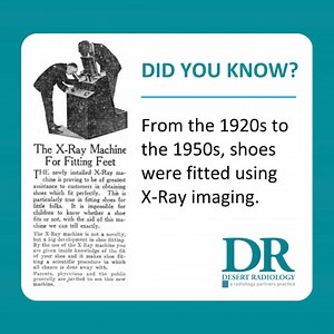 Shoe👟 stores were using X-ray fluoroscopes, also known as, X-ray shoe fitters, Pedoscopes, and Foot-o-scopes, to help customers find the perfect 👍 fit. Customers would put their feet into an opening at the bottom of the machine, while a clerk would use their hands to adjust the shoe around the foot. The X-ray tube in the base of the machine would produce a fluorescent image of the customer's foot bones, which they could see through a viewing hole at the top. The fluoroscopes were a marketing t
