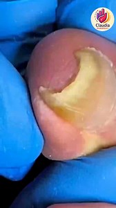 2.1K views · 22 reactions | Ep.826 Summer grocery shopping with label reading tips  #FoodLabelTips #HeartHealthyDiet #HealthyLiving | Claudia Pandolfi | Facebook