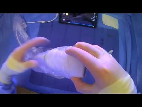 How To Put The Sterile Ultrasound Probe Cover On