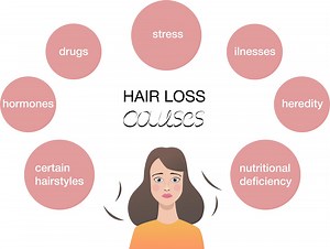 Female Hair Loss Treatment, Pattern Baldness & PRP Treatment for Women