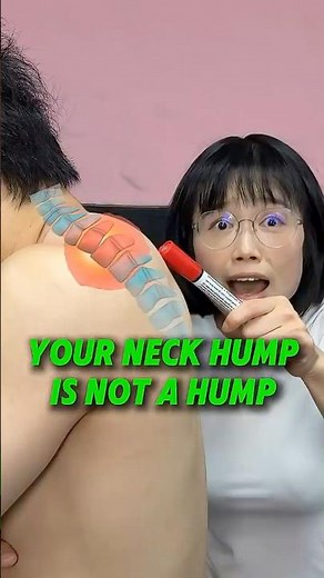 Stop cracking and stretching it—you’re chasing the wrong enemy! 🤯🛑 #neckhump #posture #alignment