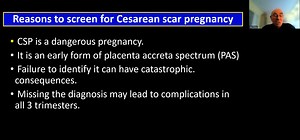 3.3K views · 38 reactions | Part 2 - Early first-trimester transvaginal ultrasound screening for cesarean scar pregnancy in patients with previous cesarean delivery: analysis of the evidence part 2 | American Journal of Obstetrics & Gynecology | Facebook