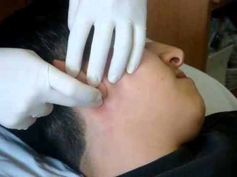 Larson Maneuver | NEJM