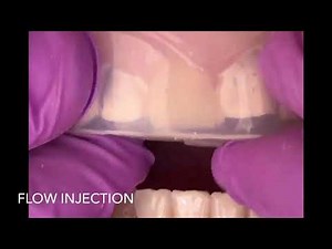 flow injection technique