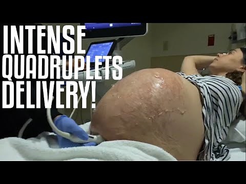 INTENSE QUADRUPLETS LABOR & DELIVERY VLOG! (BIRTH VLOG) | *RAW & REAL! | TFYV #18