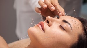 Facial Acupuncture Is in Demand — Here’s Why
