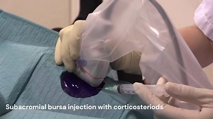 13 reactions | Needling and Lavage in Rotator Cuff Calcific Tendinitis. Ultrasound-Guided Technique. #shoulderelbow #sportsmedicine https://bit.ly/452mvuc | The Journal of Bone & Joint Surgery (JBJS) | Facebook