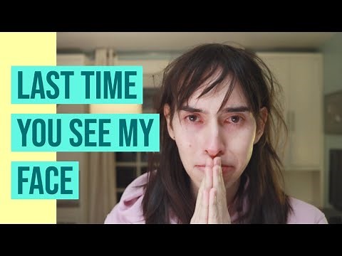 The Last Time You See My Face | FFS MTF Transgender Surgery