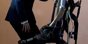 Bionic Man is The Future of Humans, Not Robots