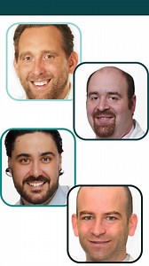 11 reactions | We’re partnering with some of the leading orthopedic surgeons in #CNY to bring MakoSmartRobotics™ technology to Crouse for total knee, partial knee and total hip orthopedic procedures. Our joint replacement experts have access to this latest technology to relieve painful arthritis in knees and hips. Learn more and find a surgeon at crouse.org/services/robotic-surgery/mako/ | Crouse Health | Facebook