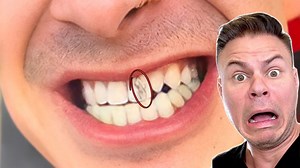 2.7K views · 56 reactions | Can You Really Tattoo Your TEETH?! 醴 #teeth #tattoo #dentist | TheBentistofficial | Facebook