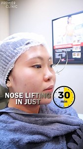 Nose Thread lift is a quick and simple nonsurgical procedure with minimal downtime. Threadlift Treatment lifts the skin through the barb on the thread. After thread lift treatment, there are scars created in our deep skin tissues, which connect with our skin tissue to achieve the result of lifting. #AestheticallyYours #PremierClinic #aesthetics #aestheticchallenge￼ #aestheticclinic #aestheticClinicMalaysia #Undereye #FaceLifting #Azharina #ThreadLift #noselifting | Premier Clinic | Facebook