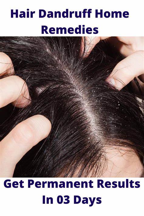 How To Get Rid Of Dandruff In Winter Naturally
