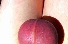 balls bruised tumblr beaten swollen testicles sweden ballbusting swedish random really some when love get