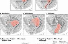 ultrasound pelvic transabdominal uterus positions retroverted cervix sonography radiology
