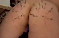torture cruel needles