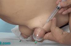 saline breast pumping pump tits inject injections hard inflation tumblr breasts infusion while quickly system