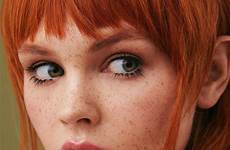 freckles redheads pecas pelirroja sproeten meisje having myteenwebcam maio joy