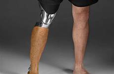 prosthetic leg prosthetics prosthesis bespoke legs real innovations limbs custom look medical 3d limb printing uses amputees wired industrial research