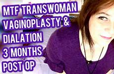 mtf vaginoplasty transwoman
