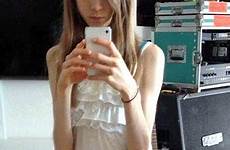 her anorexic life teens chiara chaira suffering stomach stemmed pain problems eating early says body article weight